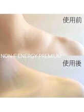 ブランシェ 富山店 × 椿/ノンFエナジー使用前後