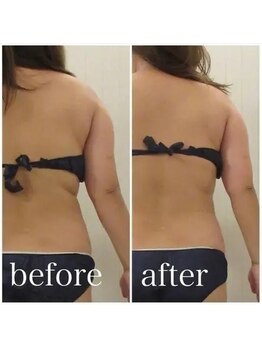 グレイスボディ ヨークタウン坂東店(Grace Body)/痩身ビフォーアフター