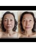 【65歳以上限定割】エイジングケア＆健脳ツボ美顔45分