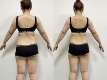 ネクストジムトウキョウ 目黒店(NEXT GYM TOKYO)/【ブライダルダイエット】