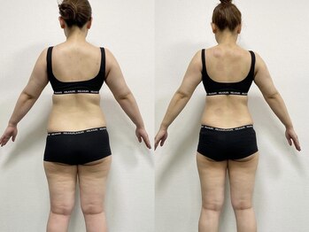 ネクストジムトウキョウ 目黒店(NEXT GYM TOKYO)/【ブライダルダイエット】