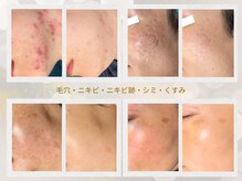 ジュパール(je pars)
