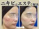 ラヴレボーテ(La Vraie Beaute)の写真