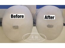 美極 トータルビューティー(美極 TOTAL BEAUTY)/恵比寿/小顔コルギ/エステ/