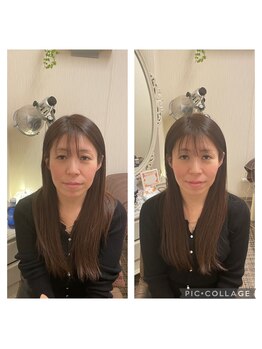 友愛はりきゅう美容整体院/ELコスメティック美容鍼