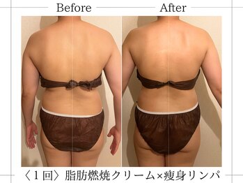 アルム(ALUM)/イベントに向けて痩せたい！！