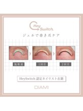 ネイルリテルナ(Nail Re.terna)/巻き爪ケア