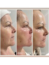 ティーボックスボーテ(TBOX beaute)/