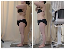 ひぺりかむ/4Day【東釧路ひぺりかむ】《参》