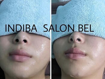 ベル(BEL)の写真/同業者/美容業界の方多数ご来店★施術後の固さやツッパリケアはBELにお任せ♪メンズインディバデビューに◎