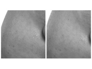 シュガー(Sugar...iyr)/プラズマニア！！