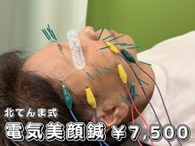 北てんま整骨鍼灸院の雰囲気（before＆afterを撮影！シワやフェイスラインのたるみをチェック）