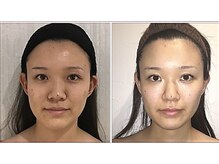 小顔整体研究所 KSラボ 藤が丘店/