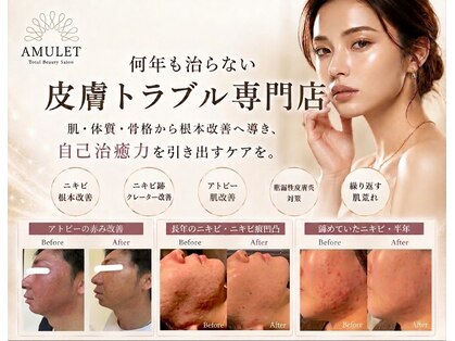アミュレット(AMULET)の写真