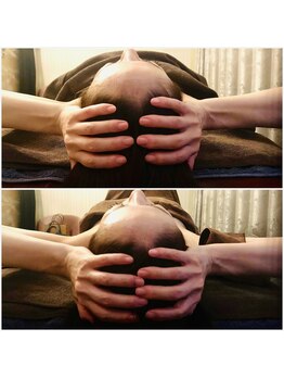 カンコルギセラピー 広島幟町店(KAN)/ドライヘットスパ