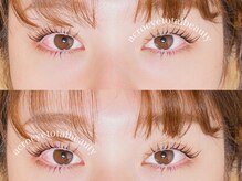 アクロ アイトータルビューティトヨナカ(ACRO eye total beauty Toyonaka)