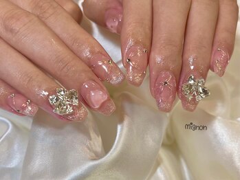 ミニョン(mignon)/やり放題120min