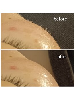 ミィ(facial salon mii)/【WAXのBefore→After】