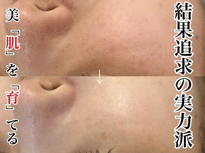 エミュ(e'mu)の写真
