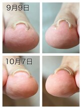 キャンディベース フクシマ(Candybase Fukushima)/一度の施術でこの効果！