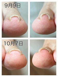 一度の施術でこの効果！