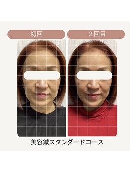 サロン ド ハリッシュ(Salon de HARISH)/フェイスラインの変化