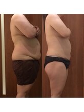 プリンセス バイ セイフティプリンセス 長野店(PRINCESS)/矯正×マシーンのW効果で結果◎