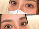 ウェヌス アイ ビューティ(VENUS eye beauty)の写真/お顔の印象は目元で決まる！？特別なイベントに向けてご準備を！お目元に悩みやコンプレックスがある方も◎