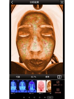 ミーシェ(Meshie)/AI肌診断機