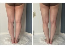 モア(moa)/茅ヶ崎/湘南/平塚/下半身