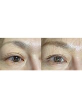 トータルビューティーサロンリア(Li'a)/【40代後半のお客様】