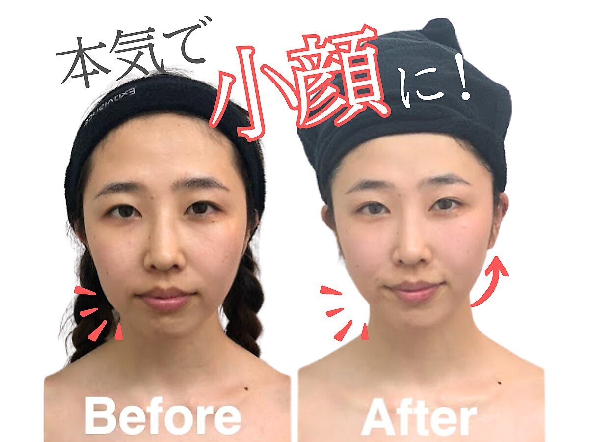 小顔フェイスラボ 千葉店(小顔Face Labo.)｜ホットペッパー
