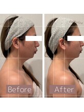 エステティックサロン ラ ベルタ(Esthetic Salon La Belta)/華奢みえコルギ