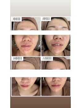 ホワイトアクア 四日市店(WHITE AQUA)/結果重視サロン四日市ララピール