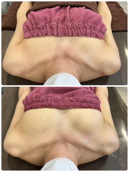 ロココ 豊田店(Rococo)/ビフォーアフター