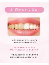 ルルネイル(Lulu Nail)/月一万円で通い放題