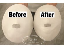 美極 トータルビューティー(美極 TOTAL BEAUTY)/恵比寿/小顔コルギ/エステ/