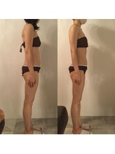 ピカケ(PIKAKE)/筋膜リリース