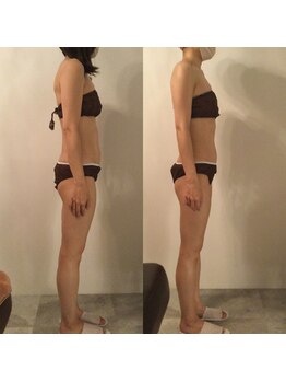 ピカケ(PIKAKE)/筋膜リリース