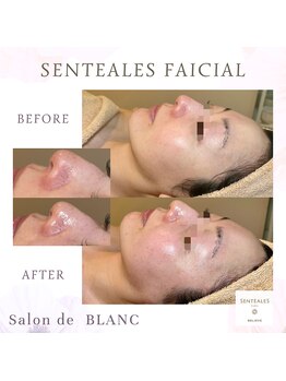 サロン ド ブラン アオヤマ(Salon de BLANC AOYAMA)/SENTEALESフェイシャル