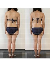 ボディメイクサロンアプローズ/背中スッキリ