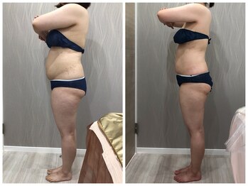 ベルネ(BELLUNE)/ベルネ式フォースカッター