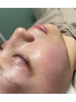 アリュール(Allure)の写真/皮脂が固まり、ターンオーバーが整わない…クレンジングの洗い残しや化粧品の蓄積等が原因で毛穴悩みに…