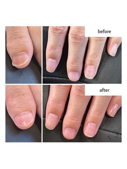 ケアプラス(care plus)/ハンドネイルケア