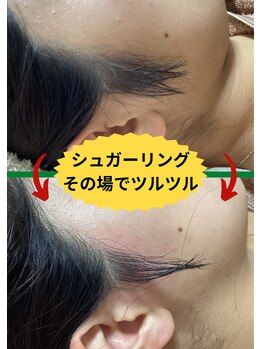 ディスイズミー シュガーリング(This is me Sugaring)/【シュガー】細かい箇所も得意