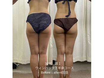 エステサロン クレイドルフェザー/冷え・むくみ、下半身痩せに◎