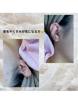 ハレココロ(Harekokoro)/産毛やくすみが気になる方