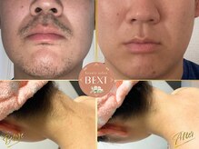 ★Before　After★