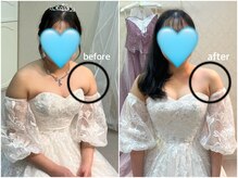 クオーレ(Cuore)/１ヶ月のbefore/after