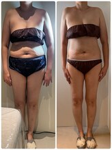 エムグラッティチュード(M gratitude)/全身リンパマッサージ90分